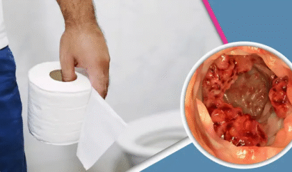 পেটে ব্যথা, মলের সঙ্গে রক্ত? হতে পারে এই রোগের লক্ষণ সাবধান পেটে ব্যথা, মলের সঙ্গে রক্ত? হতে পারে এই রোগের লক্ষণ সাবধান