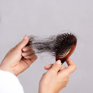 অতিরিক্ত চুল ঝরে পড়ছে? এই সমস্যায় কি করবেন, দেরি না করে জেনেনিন