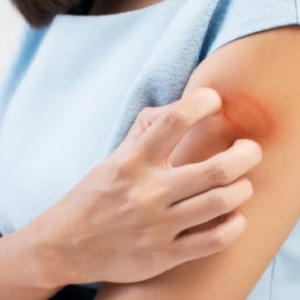 ত্বকের জেদি দাদ নিয়ে নাজেহাল? ৫টি ঘরোয়া টোটকাতেই হবে মুশকিল আসান!