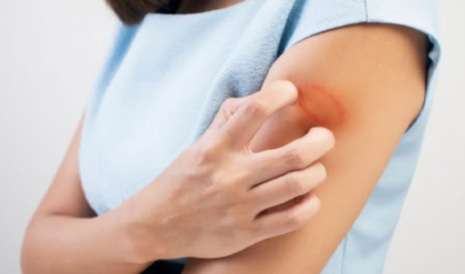 ত্বকের জেদি দাদ নিয়ে নাজেহাল? ৫টি ঘরোয়া টোটকাতেই হবে মুশকিল আসান!