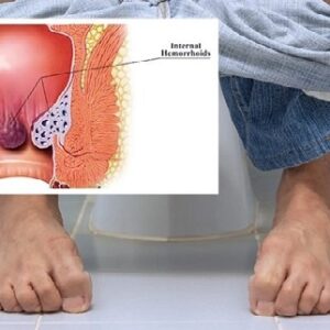 ওষুধ ছাড়াই মুক্তি পেতে পারেন অর্শরোগ থেকে, এরজন্য আপনার যা যা করণীয় জানুন এক্ষুনি
