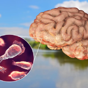 কেরলে ‘ব্রেন-ইটিং অ্যামিবা’ আতঙ্ক, ২৫ মাসেই ২১১ জন আক্রান্ত, মৃত ৫৩; সংসদে ভয়ঙ্কর তথ্য দিলেন কেন্দ্রীয় মন্ত্রী,