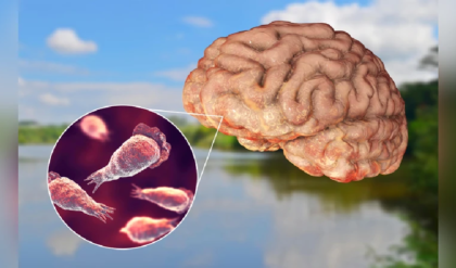 কেরলে ‘ব্রেন-ইটিং অ্যামিবা’ আতঙ্ক, ২৫ মাসেই ২১১ জন আক্রান্ত, মৃত ৫৩; সংসদে ভয়ঙ্কর তথ্য দিলেন কেন্দ্রীয় মন্ত্রী,