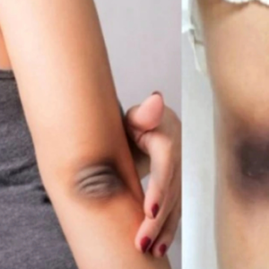 হাঁটু, কনুই ও গোড়ালির কালচে দাগ নিয়ে আর চিন্তা নয়! ৩টি ঘরোয়া উপায়ে ফিরিয়ে আনুন ত্বকের উজ্জ্বলতা!