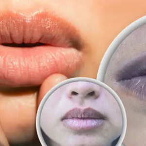 ঠোঁটের রং পরিবর্তন, লুকিয়ে থাকতে পারে ক্যানসারের বিপদ