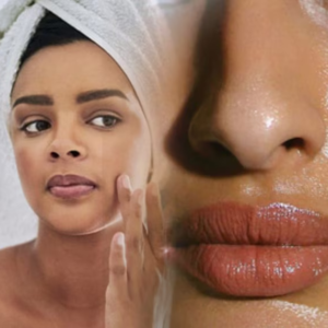 তৈলাক্ত ত্বকের অস্বস্তি আর ব্রণকে বিদায় জানান চিরতরে! রইল ৫টি কার্যকরী ঘরোয়া উপায়