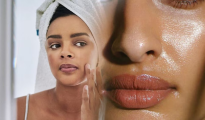 তৈলাক্ত ত্বকের অস্বস্তি আর ব্রণকে বিদায় জানান চিরতরে! রইল ৫টি কার্যকরী ঘরোয়া উপায়