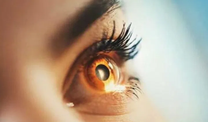 চোখ দেখে বুঝেনিন থাইরয়েডে ভুগছেন কিনা, শিখেনিন ট্রিক