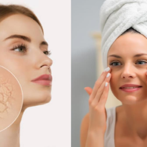 শীতে শুষ্ক ত্বকের যত্নে মধু কীভাবে মাখবেন মধু জানুন টেকনিক