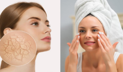 শীতে শুষ্ক ত্বকের যত্নে মধু কীভাবে মাখবেন মধু জানুন টেকনিক