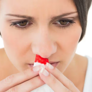 নাক থেকে রক্ত পড়া? দ্রুত আরাম পেতে যা করবেন