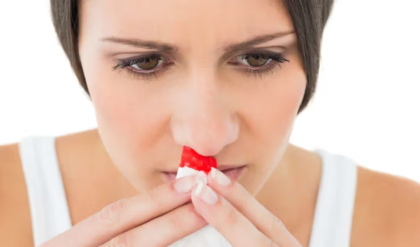 নাক থেকে রক্ত পড়া? দ্রুত আরাম পেতে যা করবেন