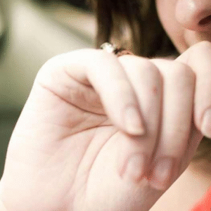 নখ কামড়ানোর বদভ্যাস আছে আপনার? তাহলে কেন সতর্ক হবেন পড়ুন