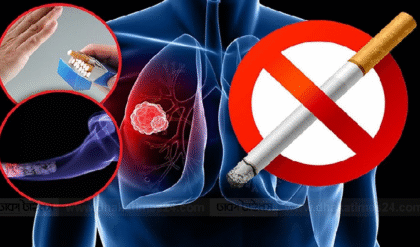 ধূমপানের ফলে যেসব সমস্যা হতে পারে, জানলে শিউরে উঠবেন