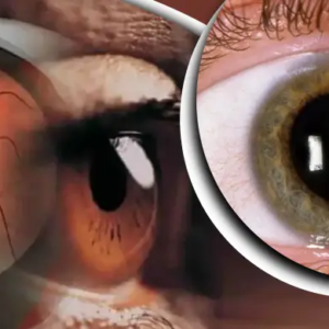 ডায়াবেটিক রেটিনোপ্যাথি রোগটি কী? এড়িয়ে না গিয়ে পড়ুন