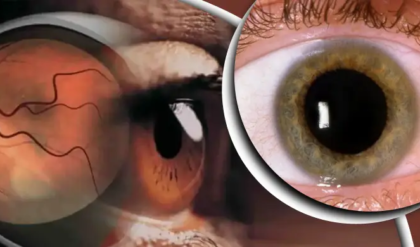 ডায়াবেটিক রেটিনোপ্যাথি রোগটি কী? এড়িয়ে না গিয়ে পড়ুন