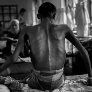 যক্ষ্মা মুক্ত বাংলা গড়ার শপথ! দেগঙ্গায় রোগীদের ৬ মাসের পুষ্টিকর খাবার দিচ্ছে গ্রাম পঞ্চায়েত