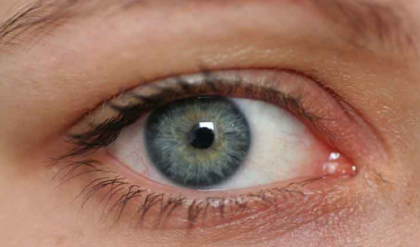 চোখের সামান্য সমস্যাও বয়ে আনতে পারে বিপদ, এড়িয়ে না গিয়ে পড়ুন