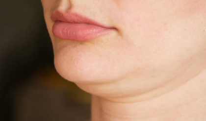 মেয়েরা, ডাবল চিন কমানোর জন্য যা করবেন? এড়িয়ে গেলে মিস