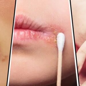 জ্বরঠোসার ব্যাথায় বিরক্ত হয়ে গেছেন, কিভাবে মুক্তি মিলবে? জেনেনিন এক্ষুনি