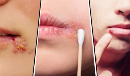 জ্বরঠোসার ব্যাথায় বিরক্ত হয়ে গেছেন, কিভাবে মুক্তি মিলবে? জেনেনিন এক্ষুনি