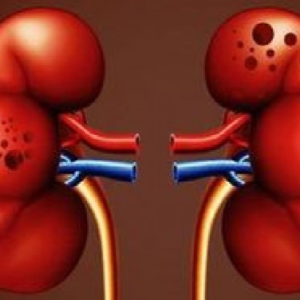 প্রাকৃতিকভাবে আপনার কিডনিকে সুস্থ রাখবে এসব পানীয়, জেনেনিন ও আপনিও খান নিয়ম করে