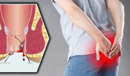 পাইলসের সমস্যা সমাধানের সেরা ৫ টি উপায় সম্পর্কে জেনেনিন এক্ষুনি