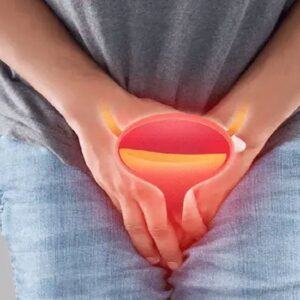 প্রস্রাবে জ্বালাপোড়া সমস্যা, কোনো রোগের লক্ষণ নয় তো? সুস্থ থাকতে অবশ্যই জেনেনিন ও সতর্ক থাকুন