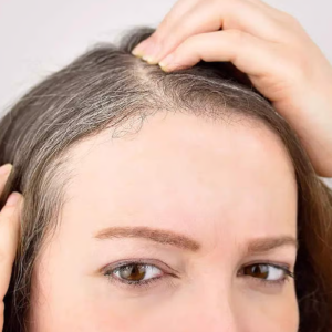 চুলের পাক ধরা দিয়েছে? তিরিশেই পুষ্টির ঘাটতি নয়তো, এড়িয়ে না গিয়ে জেনেনিন