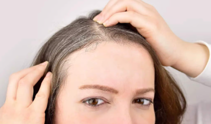 চুলের পাক ধরা দিয়েছে? তিরিশেই পুষ্টির ঘাটতি নয়তো, এড়িয়ে না গিয়ে জেনেনিন