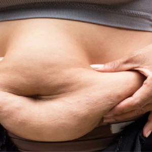 পেটের মেদ কমাতে চান? দূরে থাকুন এই ৯টি খাবার থেকে, চটজলদি জেনেনিন আপনিও