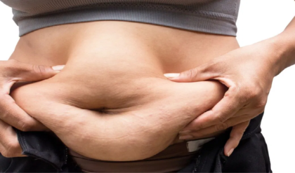 পেটের মেদ কমাতে চান? দূরে থাকুন এই ৯টি খাবার থেকে, চটজলদি জেনেনিন আপনিও