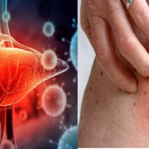 ফ্যাটি লিভারের প্রাথমিক উপসর্গগুলো জানা আছে কি? জানা না থাকলে পড়ুন ও সতর্ক থাকুন