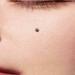 মুখের তিল কিসের ইঙ্গিত দেয় জানেন? অজানা তথ্যটি জানতে পড়ুন