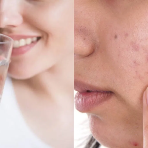 ত্বকের নানা সমস্যা দূর হবে নিমিষেই, জানুন জল খাওয়ার সঠিক নিয়ম