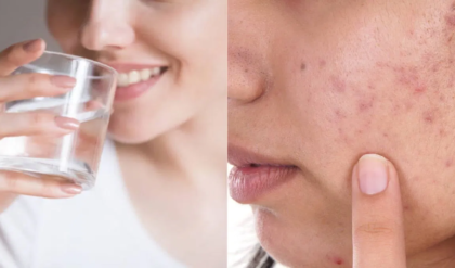 ত্বকের নানা সমস্যা দূর হবে নিমিষেই, জানুন জল খাওয়ার সঠিক নিয়ম