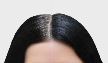 পাকা চুল প্রাকৃতিকভাবে কালো করার ট্রিক জানতে চান? শিখেনিন পদ্ধতি