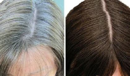 প্রাকৃতিকভাবে চুল পাকা বন্ধ করার উপায় জানেন কি আপনি? নইলে জেনেনিন