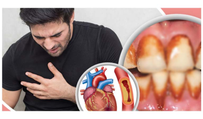 দাঁত ব্যথার মতো সাধারণ লক্ষণও হতে পারে হার্ট অ্যাটাকের ইঙ্গিত; সাবধান