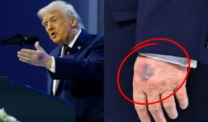 ট্রাম্পের হাতে রহস্যময় নীল দাগ! মার্কিন প্রেসিডেন্টের শরীর নিয়ে তীব্র চাঞ্চল্য?