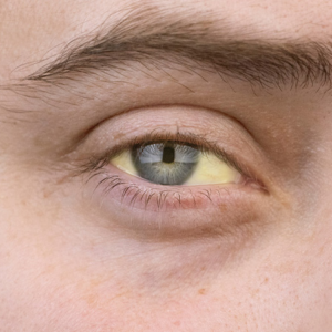 চোখ দেখেই জানা যাবে রোগ, এড়িয়ে না গিয়ে শিখেনিন