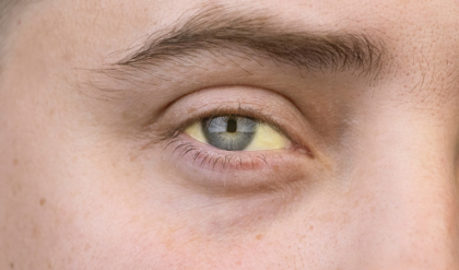 চোখ দেখেই জানা যাবে রোগ, এড়িয়ে না গিয়ে শিখেনিন