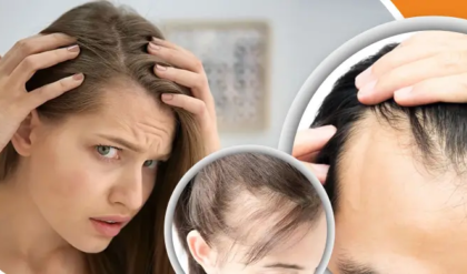 মাথার সামনের চুল কমে যাচ্ছে? টাকা খরচ না করে জানুন কীভাবে সমাধান পাবেন