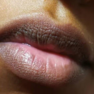 ঠোঁটের কালচেভাব নিয়ে চিন্তা? কিছু অব্যর্থ উপায় জেনেনিন