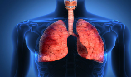 ফুসফুস ক্যানসারের লক্ষণ: কিভাবে চিনবেন? জেনেনিন ট্রিক