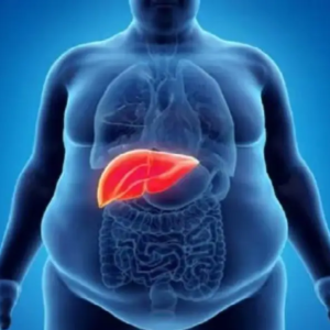 এই ৫ কারণেই আক্রান্ত হতে পারেন ফ্যাটি লিভারে, সাবধান হয়ে যান আজই