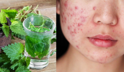 পার্লার নয়, বাড়িতেই হবে বাজিমাত! পুদিনা পাতা দিয়ে ব্রণ ও দাগ দূর করার অব্যর্থ উপায়