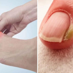 নখকুনির যন্ত্রণায় হাঁটাচলা দায়? এই ঘরোয়া টোটকাতেই মিলবে ম্যাজিকের মতো আরাম