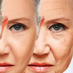 বয়স বাড়বে কিন্তু চেহারা থাকবে চিরসবুজ! মুখের বলিরেখা দূর করার ৫টি জাদুকরী ঘরোয়া টোটকা