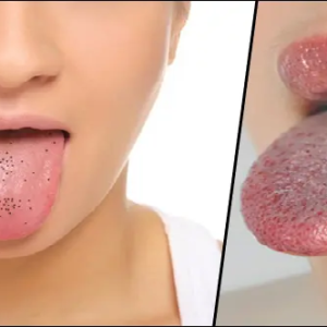 কথা বলতে লজ্জা পাচ্ছেন? জিহ্বার কালো দাগ দূর হবে নিমেষেই; ঘরোয়া এই পদ্ধতিগুলো কি জানতেন?